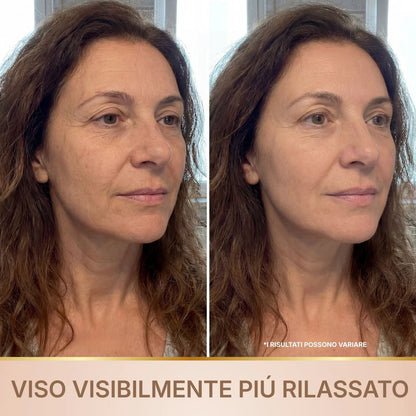 Velvionna – Siero Coreano Effetto Lifting dalla Prima Applicazione