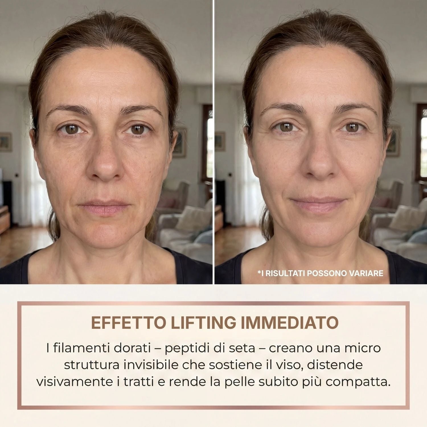 Velvionna – Siero Coreano Effetto Lifting dalla Prima Applicazione