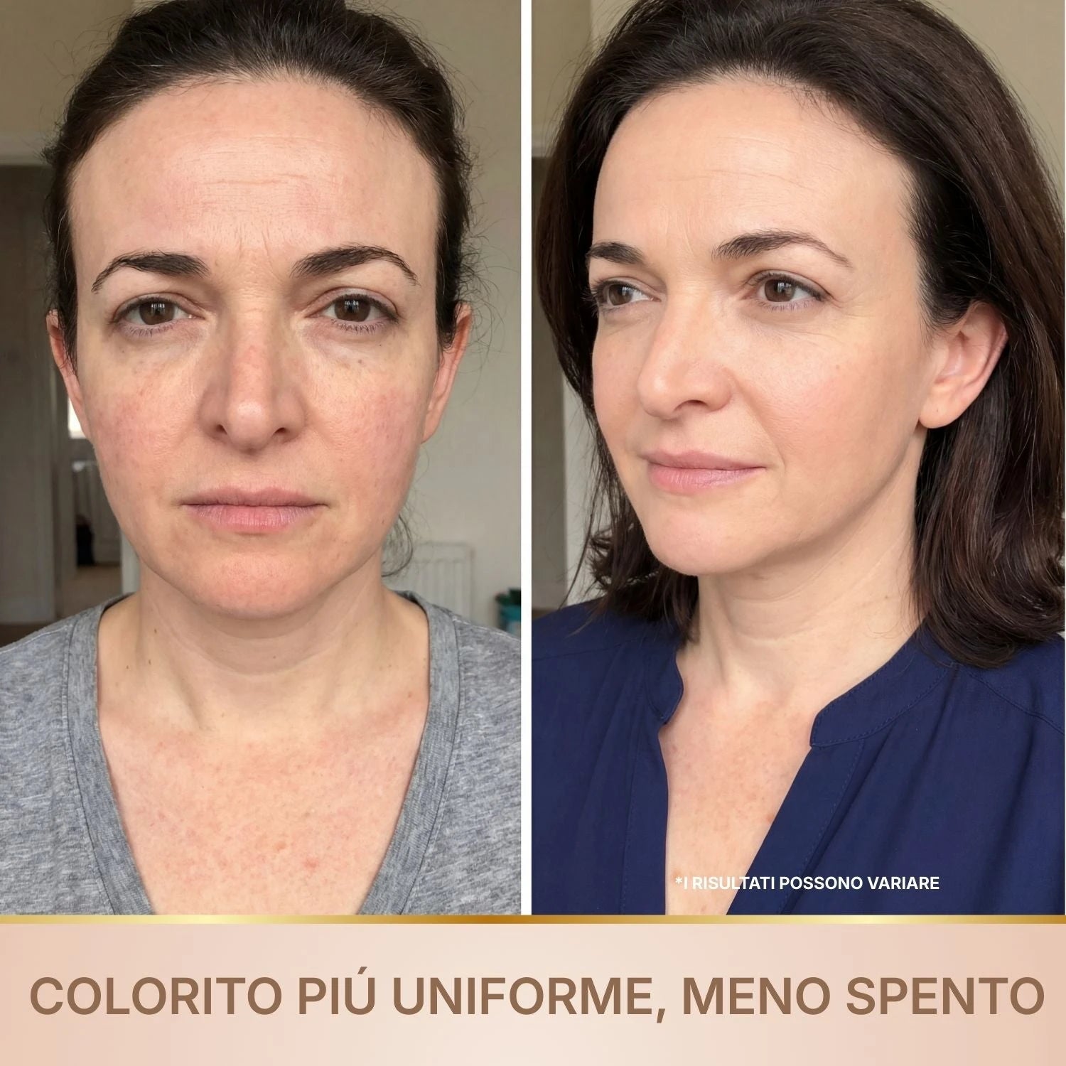Velvionna – Siero Coreano Effetto Lifting dalla Prima Applicazione