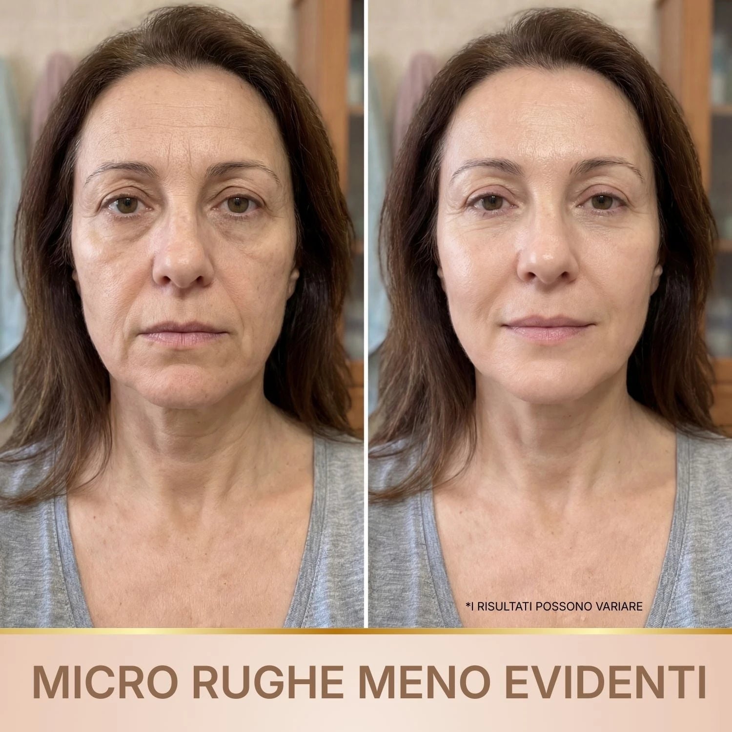 Velvionna – Siero Coreano Effetto Lifting dalla Prima Applicazione