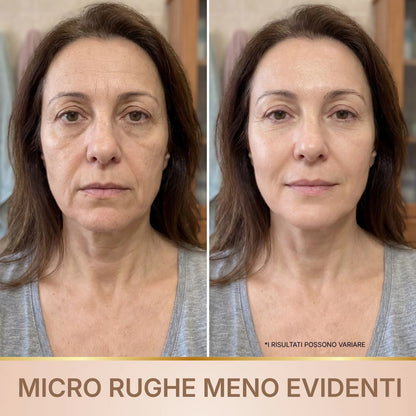 Velvionna – Siero Coreano Effetto Lifting dalla Prima Applicazione