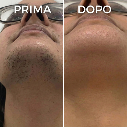 Siero Anti-Ricrescita Peli | Formula Vegetale