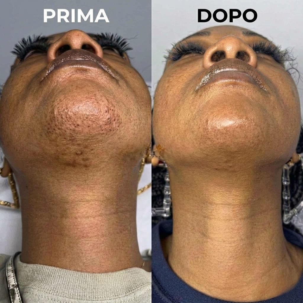Siero Anti-Ricrescita Peli | Formula Vegetale
