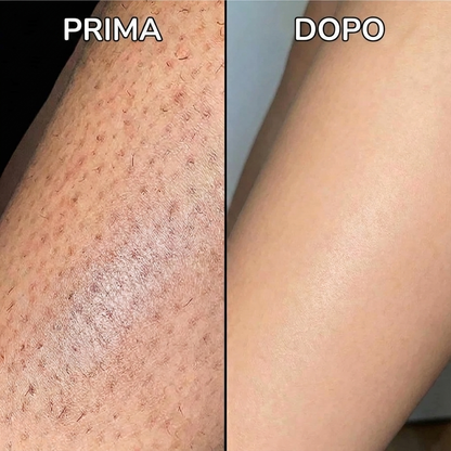 Siero Anti-Ricrescita Peli | Formula Vegetale