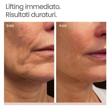 Siero Lifting Immediato | PDRN + Peptidi