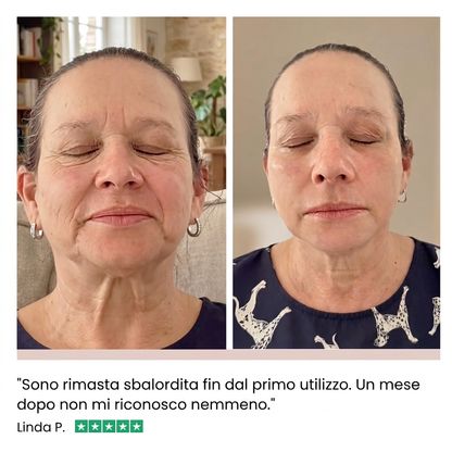 Siero Lifting Immediato | PDRN + Peptidi